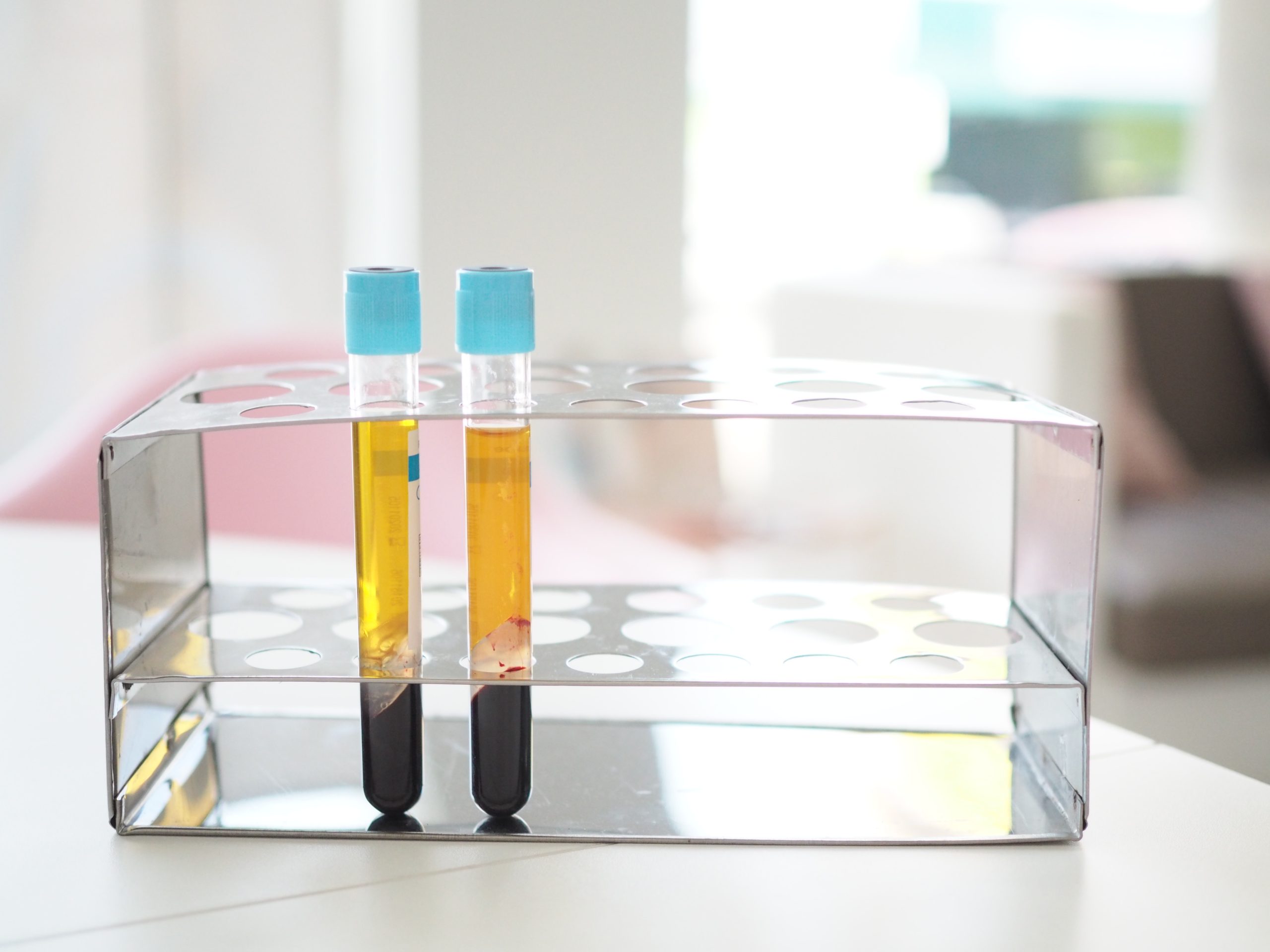 Platelet-Rich Plasma PRP Regenerative Cell Therapies Indio CA