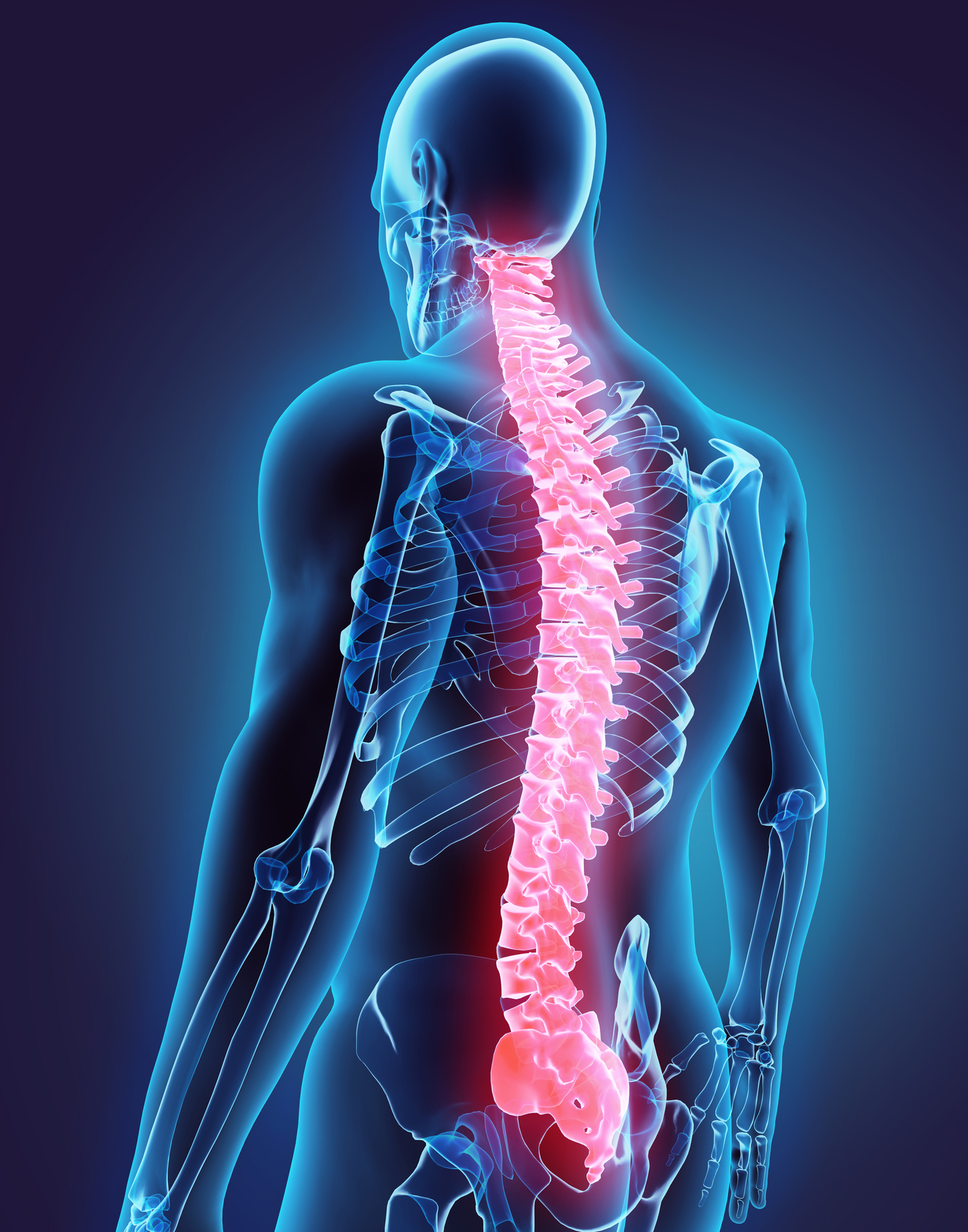 Long-Lasting Interventional Spine Relief Nerve Blocks RFA Indio CA